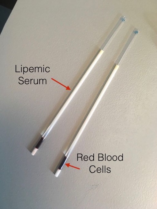 Emac COHA labeled blood