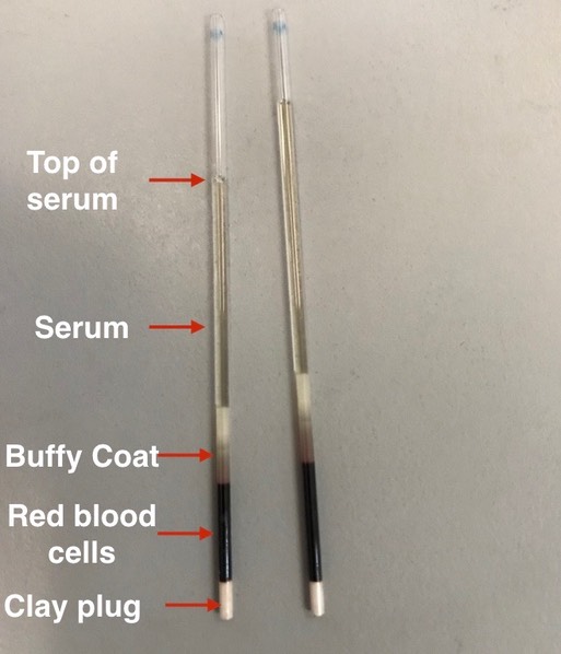 GOEA 19-406 hematocrit.001