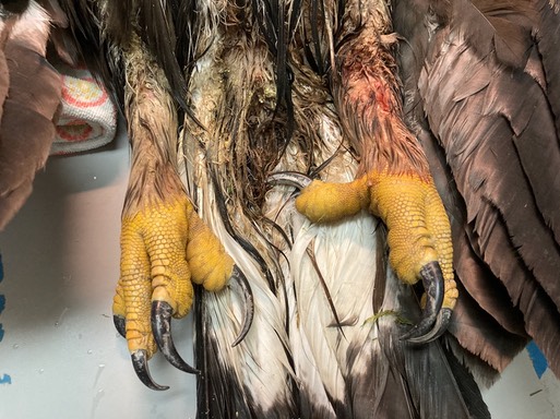 GOEA swollen legs & feet