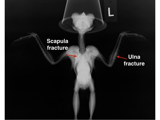WESo healed fractures.001
